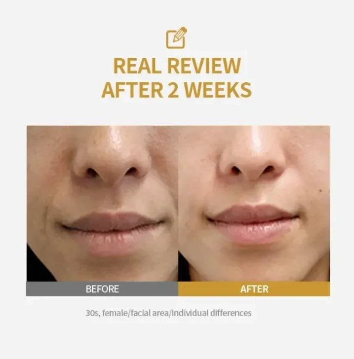 Kojic Acid Niacinamide Brightening Serum