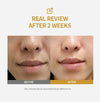 Deep Collagen Essence