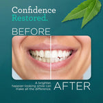 GuruNanda Hydroxyapatite Whitening Toothpaste